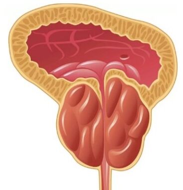 Inflammation of the prostate